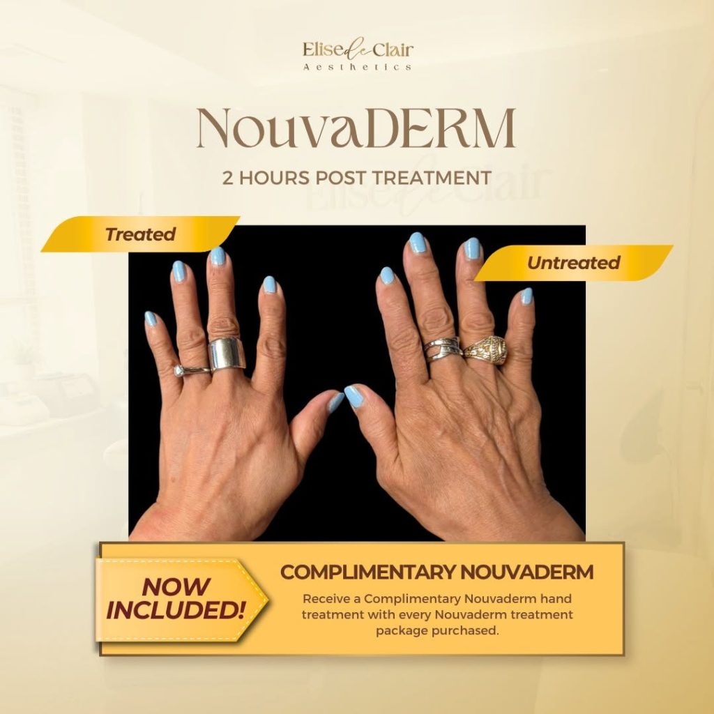 NOUVADERM BEFORE AND AFTER