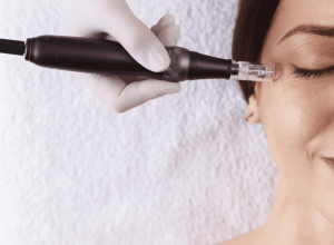 Lithium Laser Microneedling