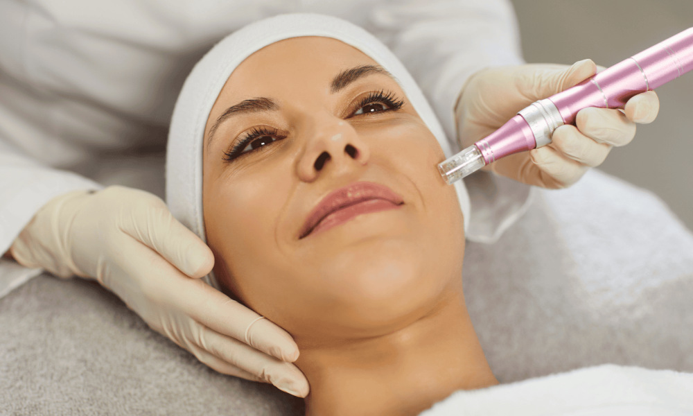 Medical Microneedling in Orland Park