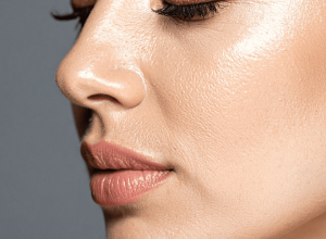 face volume restoration