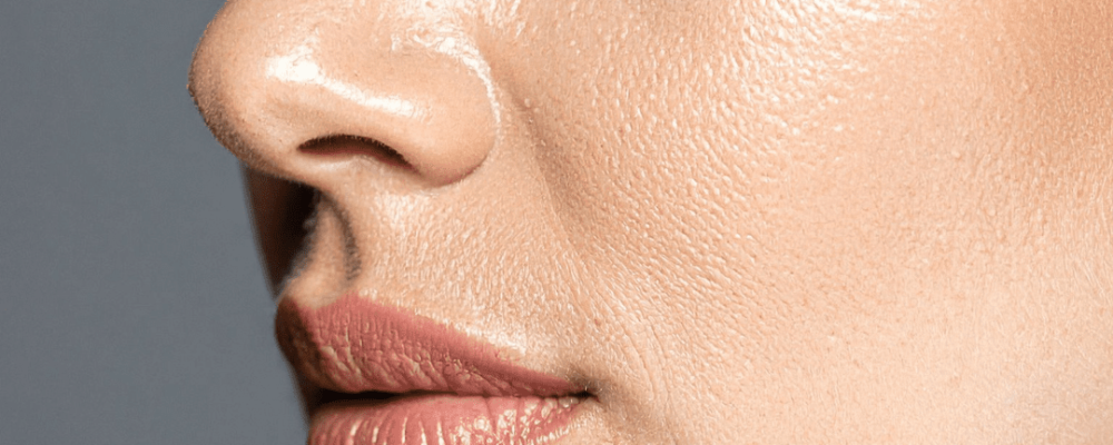 face volume restoration