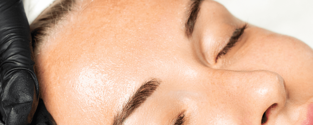 micorneedling with prp