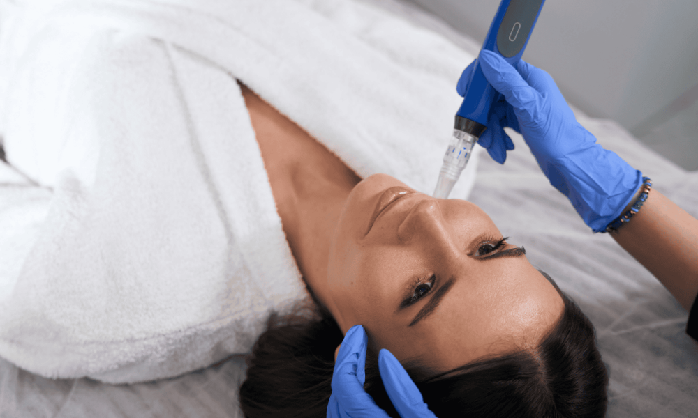 vMicroneedling vs Laser Resurfacing